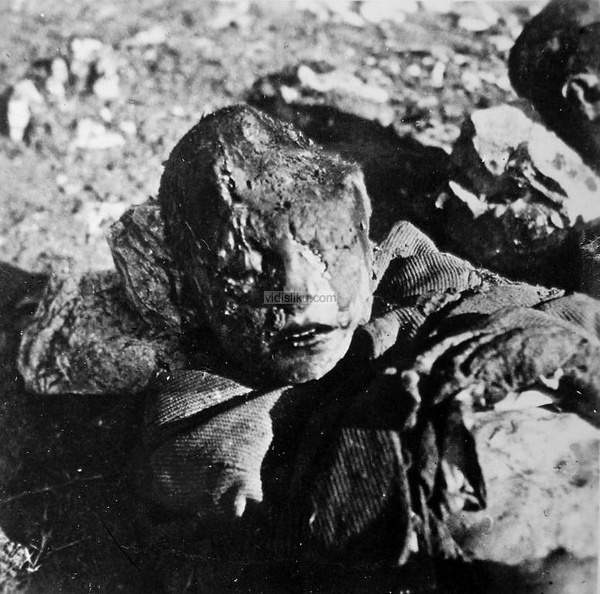 Rane-od-malja-Jasenovac.jpg